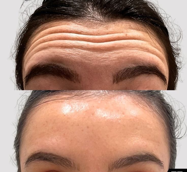 Beauty Treatment
